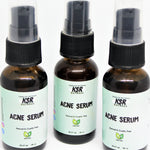 three Acne Serum bottles delightfully displayed. bottles, acne serum, natural & cruelty free