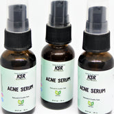 Acne Serum (Acne Out)