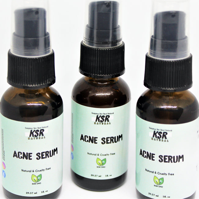 three Acne Serum bottles delightfully displayed. bottles, acne serum, natural & cruelty free