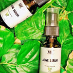 two bottles of KSR Natural Acne Serum placed on bright green leaves for display